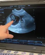Dog pregnancy ultrasound